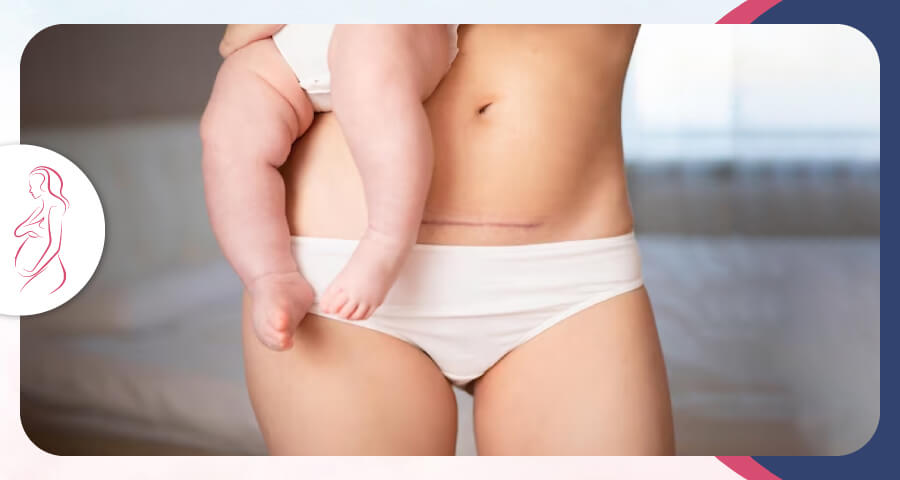 Ginecologo Quito Dr  Paul Avalos Alomia cesarea